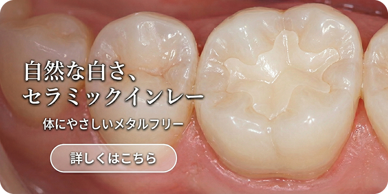 ヒロデンタルクリニックのセラミック